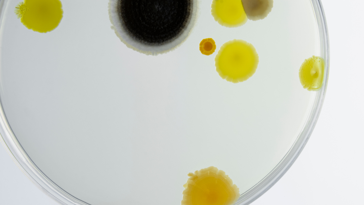 Photo of a round petri dish containing cell cultures