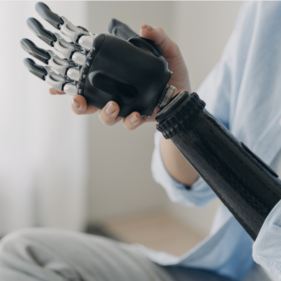 person with a disability putting together their bionic prosthetic arm