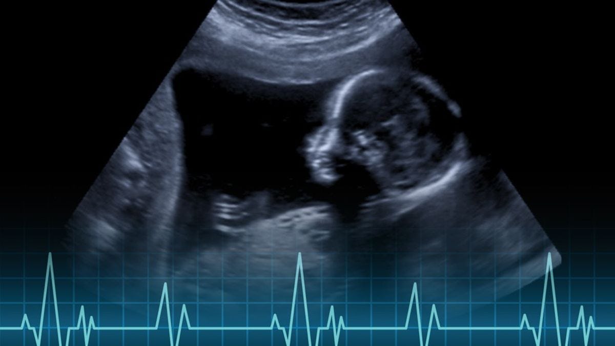 An ultrasound image of a baby in utero in the third trimester, with EKG spikes toward the bottom of the image.
