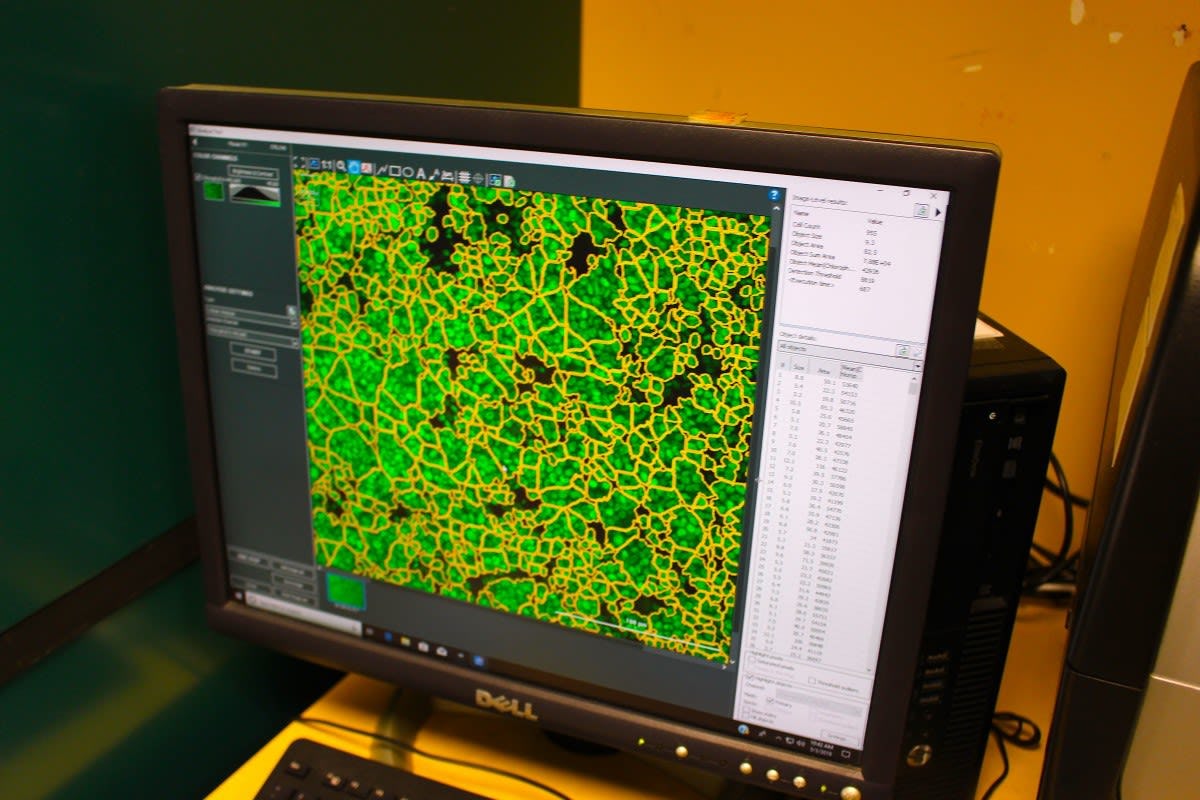 Computer screen with image of algae cells
