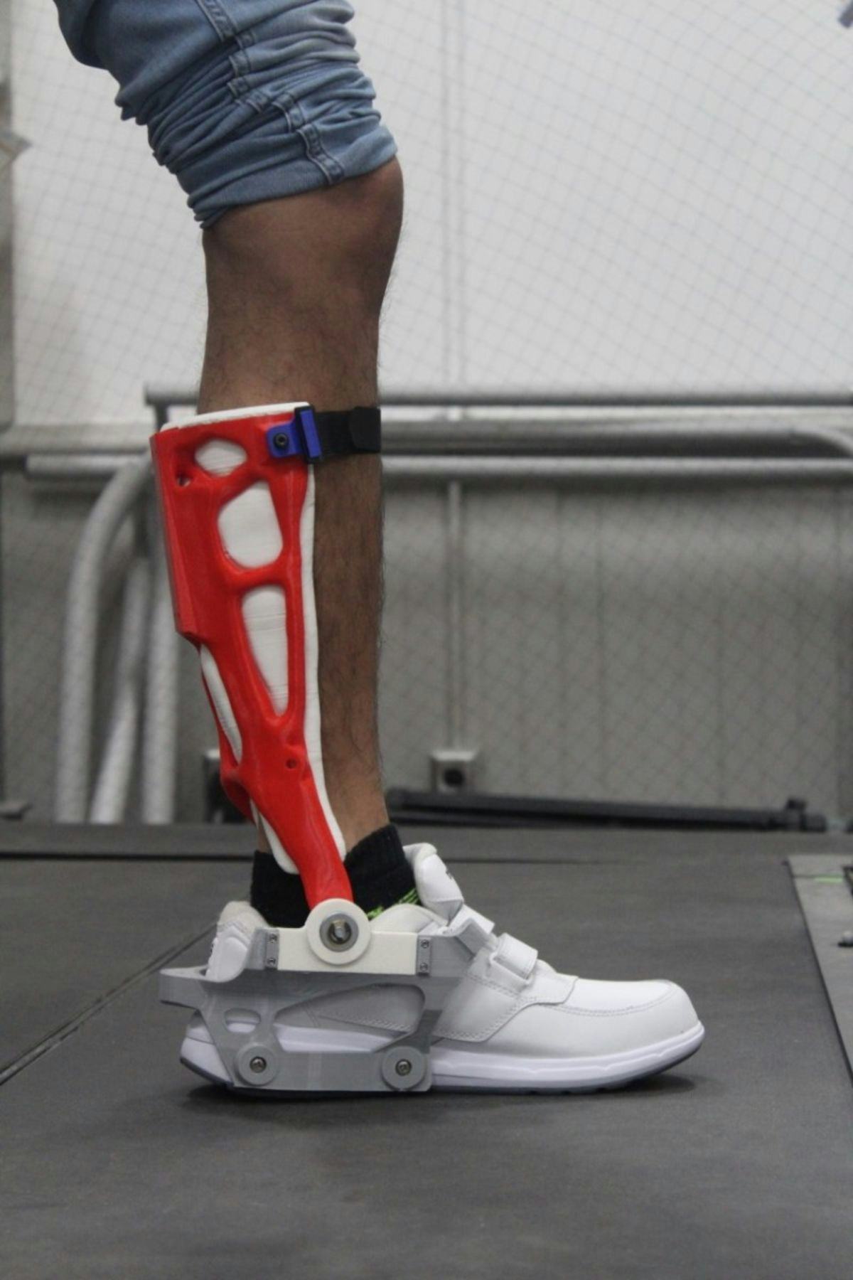 Photo of leg in robotic brace
